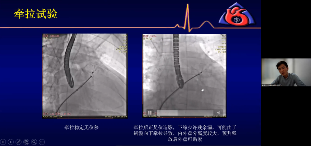 微信图片5.png 微信图片5.png