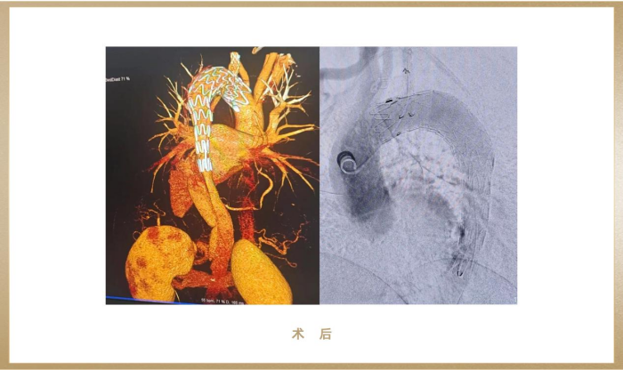 图片 4.png 图片 4.png